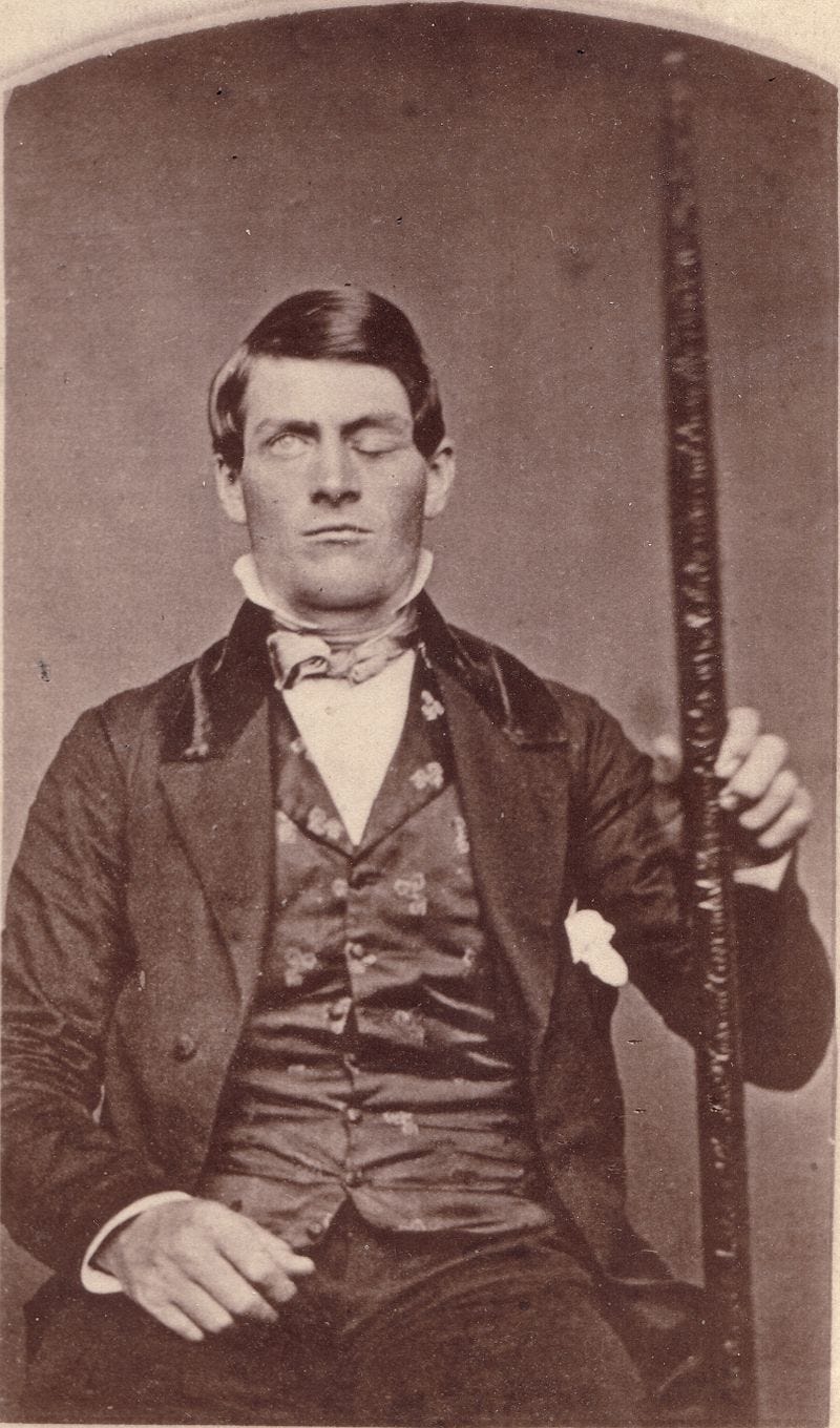 Phineas Gage after his accident