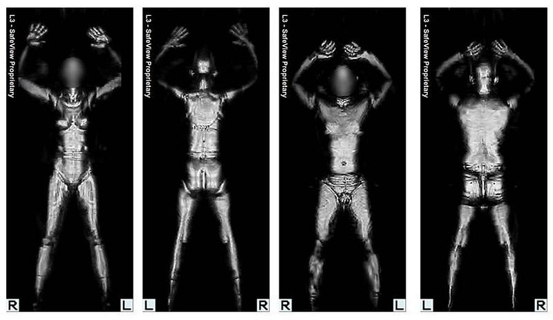 Body scanner results and radiation exposure